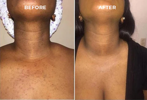 Extra Strong Peeling Oil