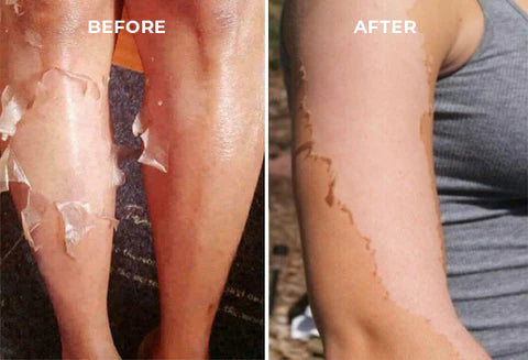 Extra Strong Peeling Oil