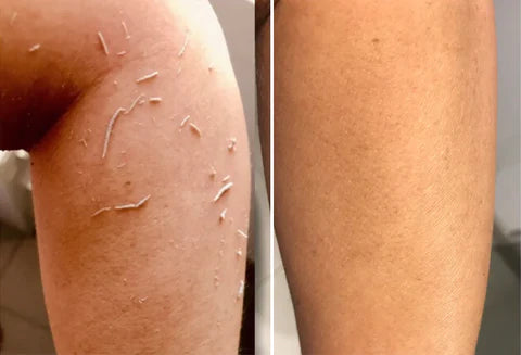 Extra Strong Peeling Oil